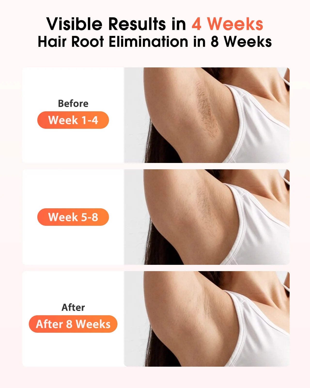 Appareils IPL Laser d'épilation 17J 999900   Light Pulses HR/SC/RA 9 niveaux épilation indolore pour tout le corps usage domestique pour hommes femmes